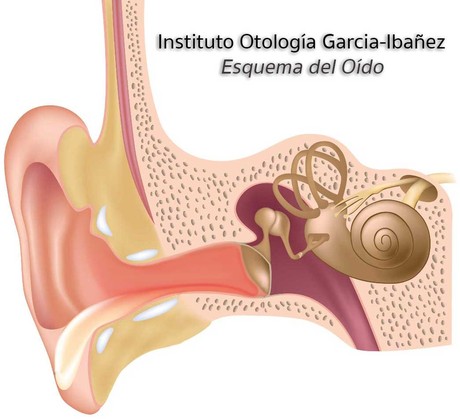 Meningitis Ótica Meningitis Ótica